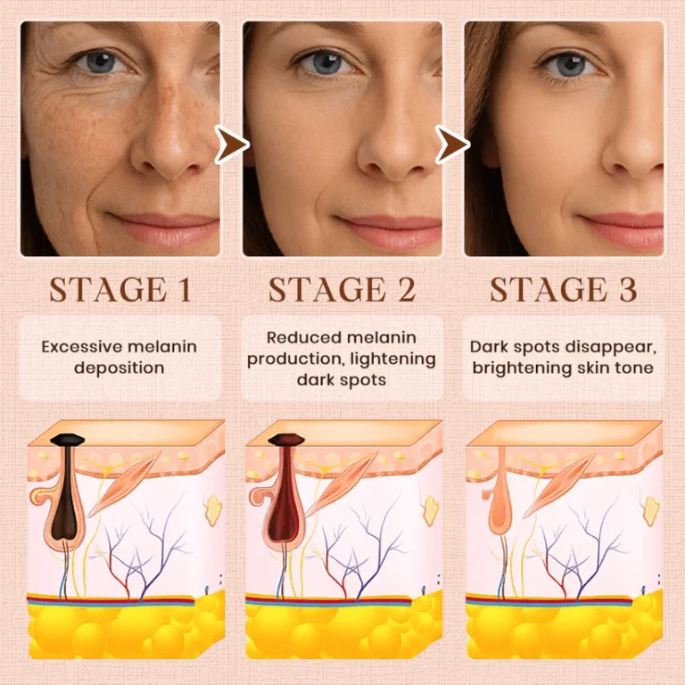 Luhaka®️ Purifying Exfoliating Gel for Acanthosis Nigricans 6 Luhaka®️ Purifying Exfoliating Gel for Acanthosis Nigricans