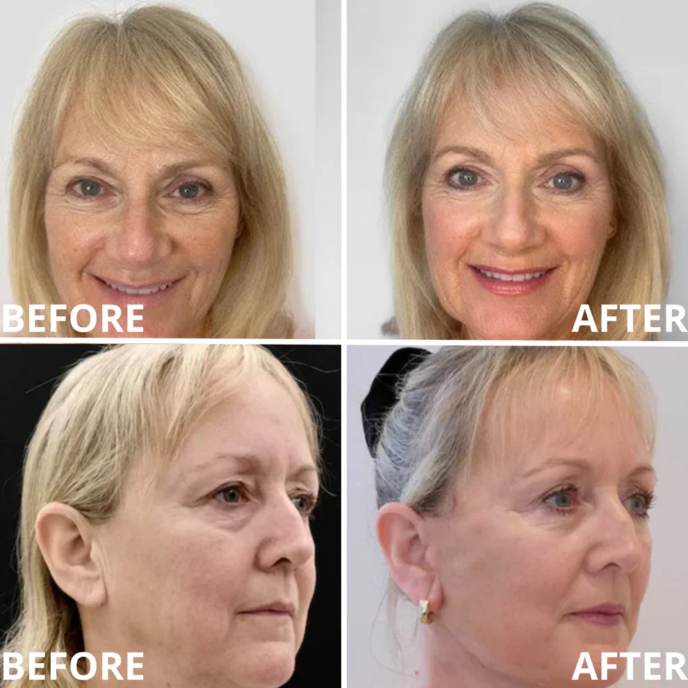 Zvoevo® Official Calcium Multi Balm | Anti-Aging, Firming & Wrinkle Care 3 Zvoevo® Official Calcium Multi Balm | Anti-Aging, Firming & Wrinkle Care