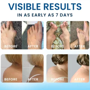 Croaie®️ BPC-157 Joint Healing Cream