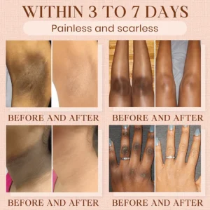 Luhaka®️ Purifying Exfoliating Gel for Acanthosis Nigricans 8 Luhaka®️ Purifying Exfoliating Gel for Acanthosis Nigricans