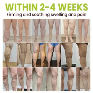 Lyyeto® Professional Leg Circulation Cream 9 Lyyeto® Professional Leg Circulation Cream