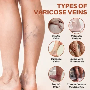 NovaRX® VeinTarget Nanotech Microneedle Patch 8 NovaRX® VeinTarget Nanotech Microneedle Patch