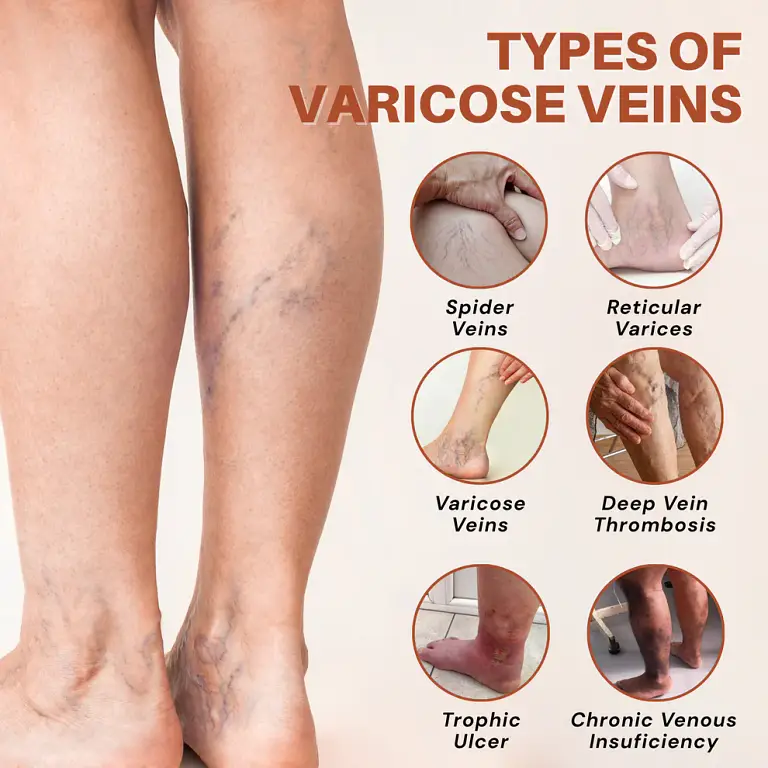 NovaRX® VeinTarget Nanotech Microneedle Patch 4 NovaRX® VeinTarget Nanotech Microneedle Patch