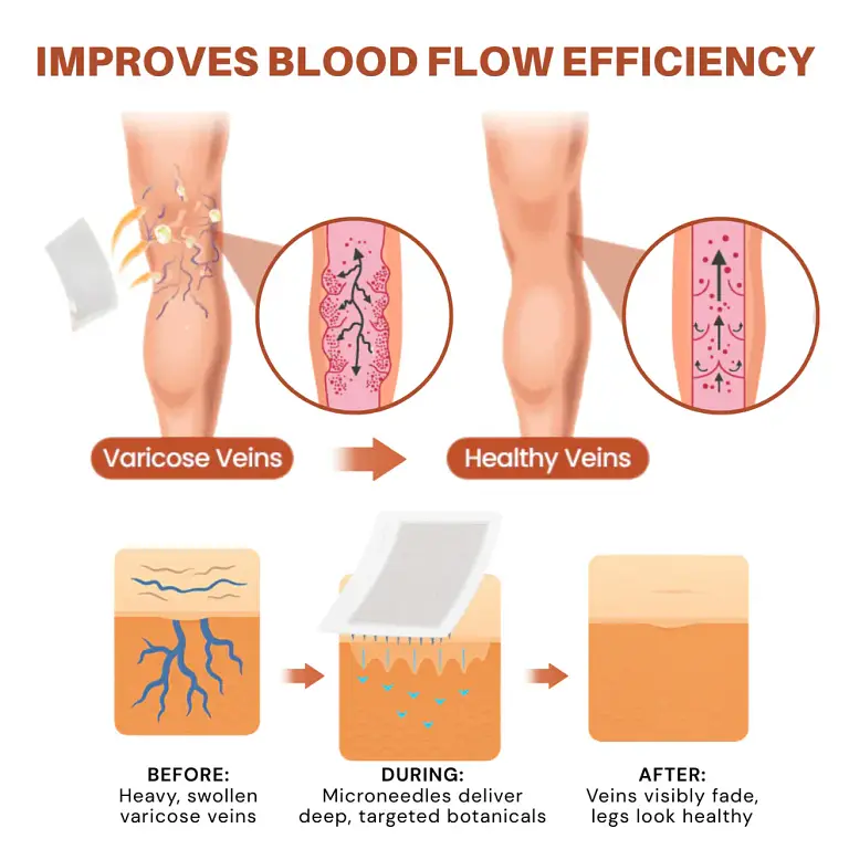 NovaRX® VeinTarget Nanotech Microneedle Patch 3 NovaRX® VeinTarget Nanotech Microneedle Patch