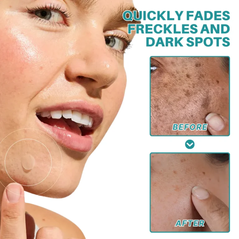 Fivfivgo® Botanical Freckles & Spot Removal Patch 2 Fivfivgo® Botanical Freckles & Spot Removal Patch