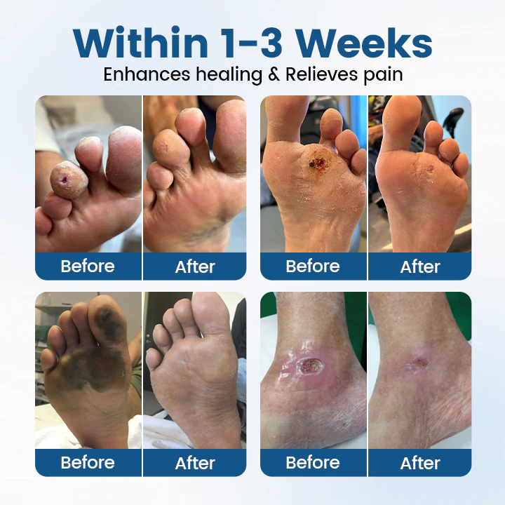 Timilk® AngioVita Diabetic Care Spray 5 Timilk® AngioVita Diabetic Care Spray