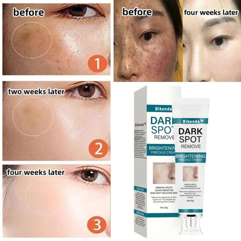Bikenda™️ Blemish Removing Beauty Cream 6 Bikenda™️ Blemish Removing Beauty Cream