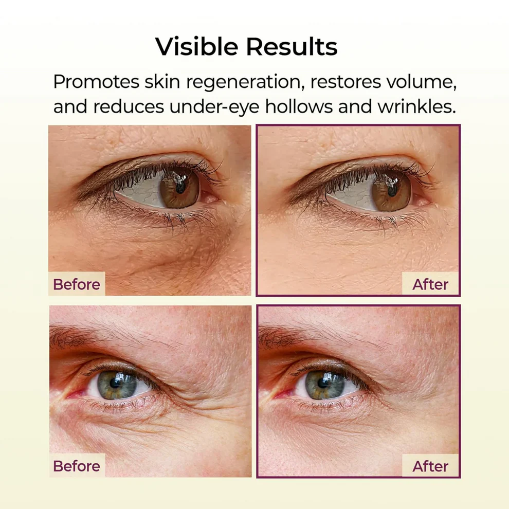 Zvoevo® Official Calcium Multi Balm | Anti-Aging, Firming & Wrinkle Care 5 Zvoevo® Official Calcium Multi Balm | Anti-Aging, Firming & Wrinkle Care