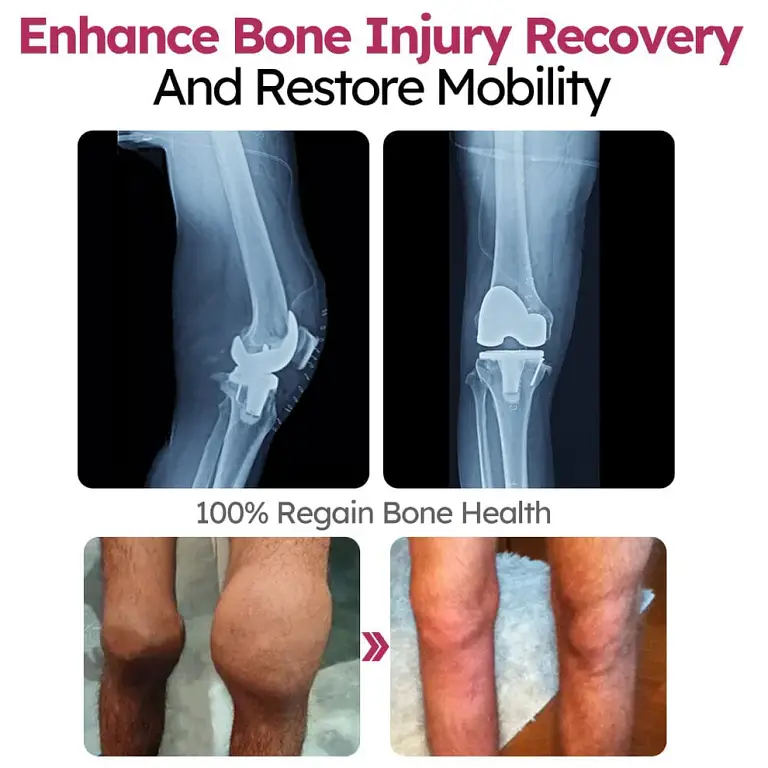 Slimoly™ Advanced Joint & Bone Renewal Cream 5 Slimoly™ Advanced Joint & Bone Renewal Cream