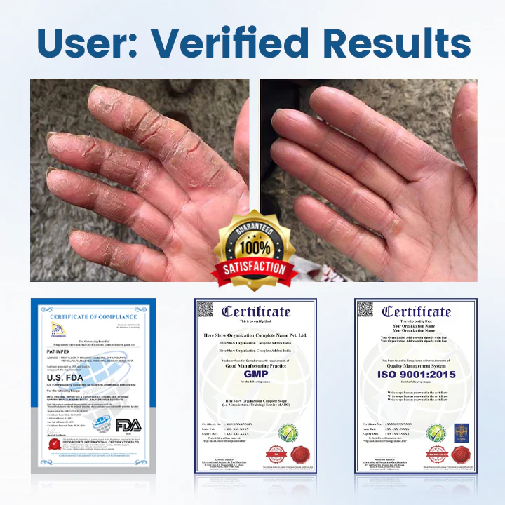 Timilk® AngioVita Diabetic Care Spray 4 Timilk® AngioVita Diabetic Care Spray