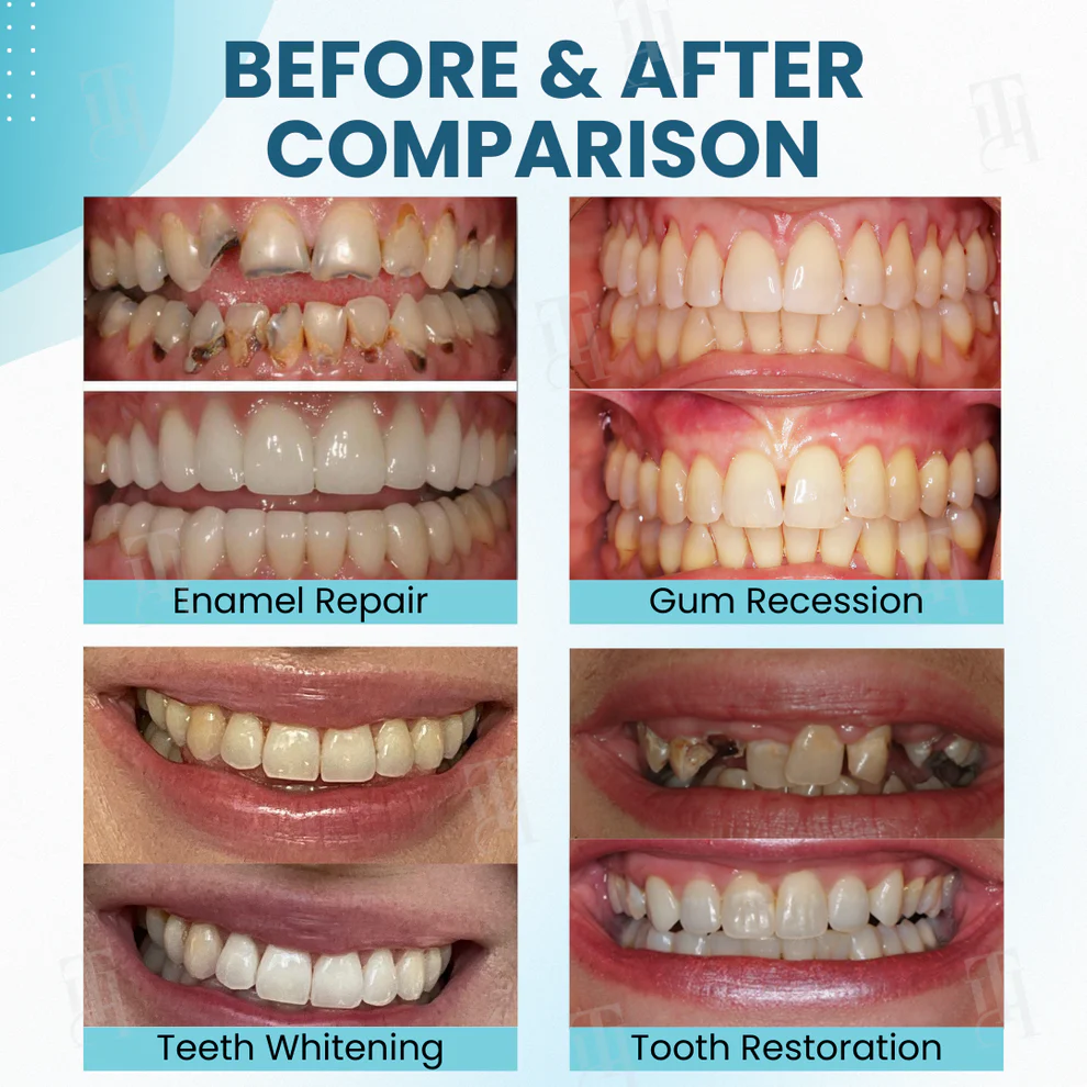 AEXZR® Makesmile Bee Venom Oral Treatment Powder 5 AEXZR® Makesmile Bee Venom Oral Treatment Powder