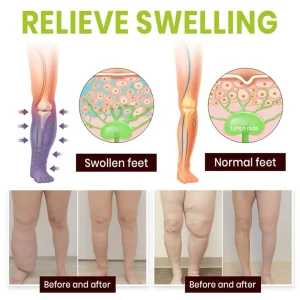 Lyyeto® Professional Leg Circulation Cream 7 Lyyeto® Professional Leg Circulation Cream