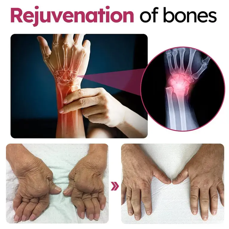 Slimoly™ Advanced Joint & Bone Renewal Cream 4 Slimoly™ Advanced Joint & Bone Renewal Cream