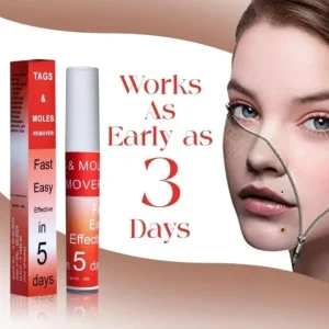 Fivfivgo™ WipeOff Tags & Mole Remover