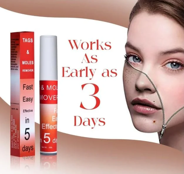 Fivfivgo™ WipeOff Tags & Mole Remover 1 Fivfivgo™ WipeOff Tags & Mole Remover