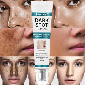 Bikenda™️ Blemish Removing Beauty Cream 9 Bikenda™️ Blemish Removing Beauty Cream