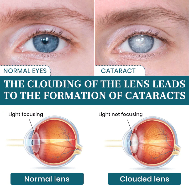 Lyyeto® OptiFusion Nano Eye Drops Serum 4 Lyyeto® OptiFusion Nano Eye Drops Serum