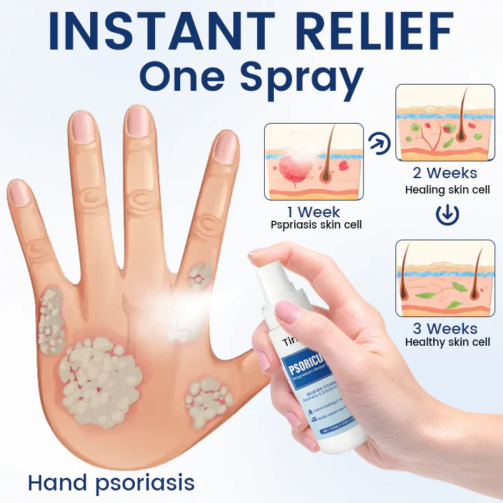 Timilk® PsoriCure Magnesium Herbal Spray 4 Timilk® PsoriCure Magnesium Herbal Spray