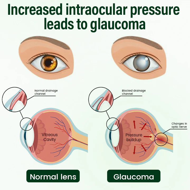 Timilk® VisionClear Nano Eye Drops 3 Timilk® VisionClear Nano Eye Drops