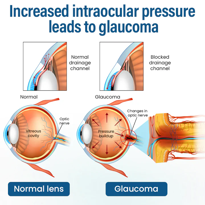 Timilk® VisionReborn Nano Eye Drops 2 Timilk® VisionReborn Nano Eye Drops
