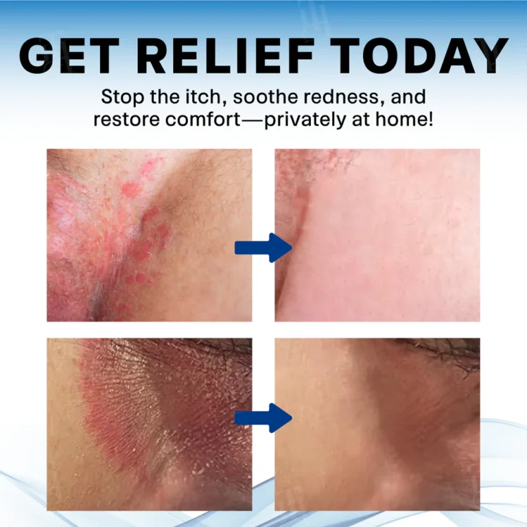 Fivfivgo® Scrotum Itchy Treatment Cream 6 Fivfivgo® Scrotum Itchy Treatment Cream