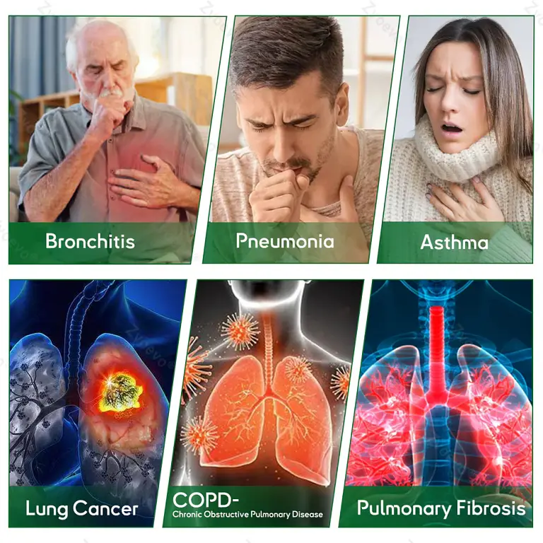 Zvoevo® DoubleNano Advanced Lung Detox Relief Patch 3 Zvoevo® DoubleNano Advanced Lung Detox Relief Patch