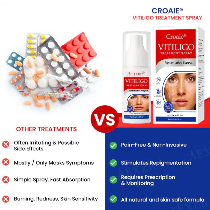 Croaie® Vitiligo Treatment Spray – No allergies 4 Croaie® Vitiligo Treatment Spray – No allergies