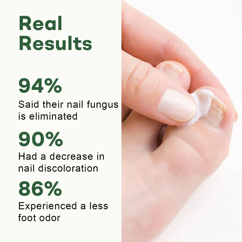 Dobshow® Nail Fungus Renewal Gel 3 Dobshow® Nail Fungus Renewal Gel