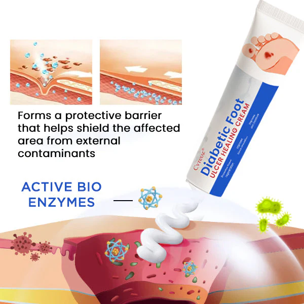 Cvreoz® Diabetic Foot Ulcer Healing Cream 2 Cvreoz® Diabetic Foot Ulcer Healing Cream