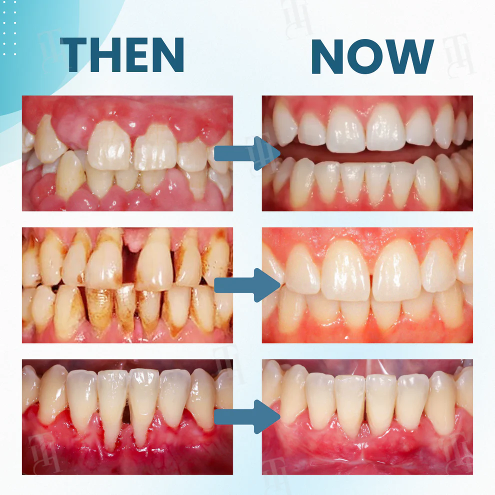 AEXZR® Makesmile Bee Venom Oral Treatment Powder 2 AEXZR® Makesmile Bee Venom Oral Treatment Powder