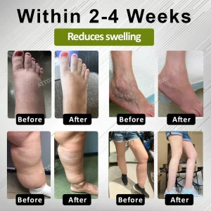 ATTDX® EdemaFree Flow Drain Massage Cream 6 ATTDX® EdemaFree Flow Drain Massage Cream