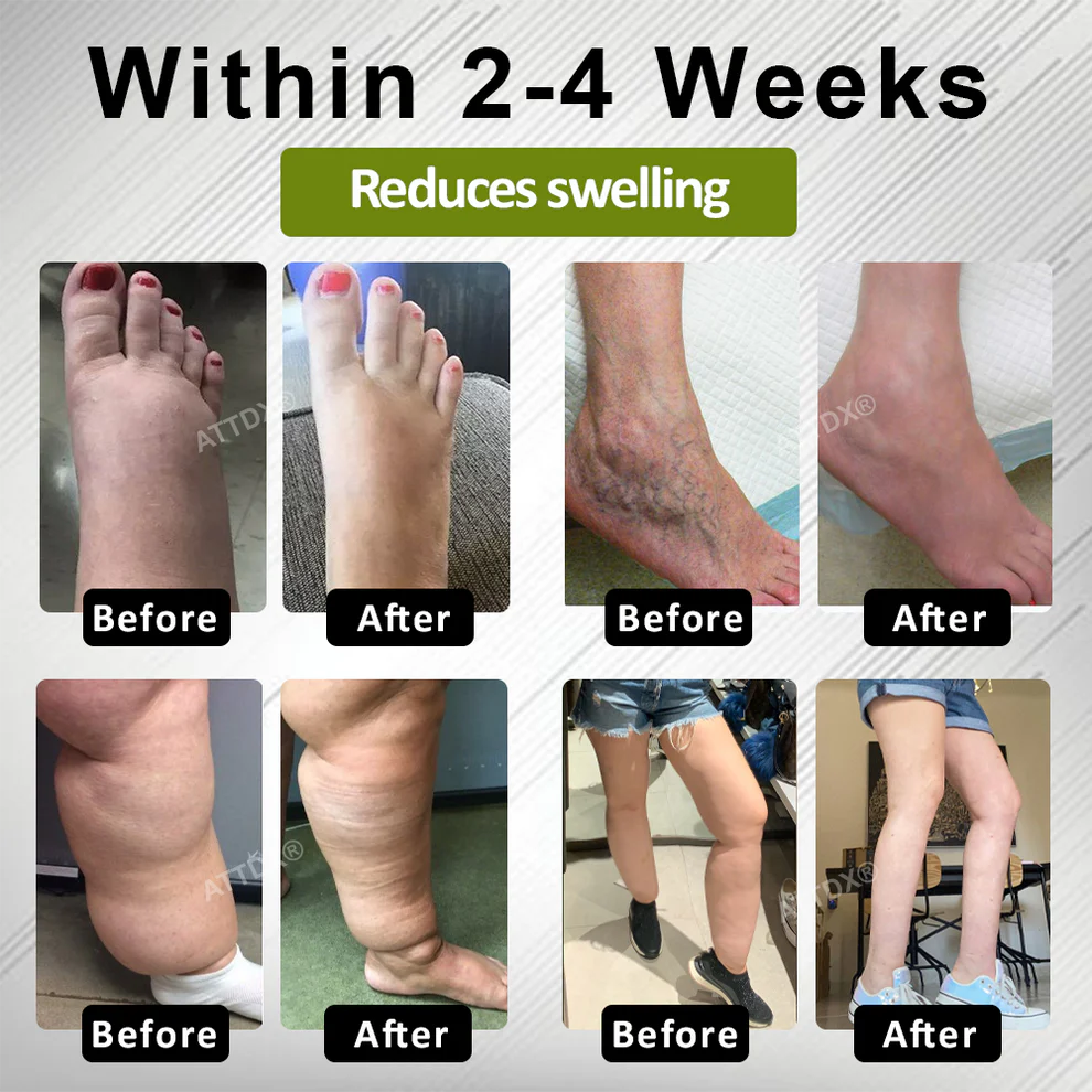 ATTDX® EdemaFree Flow Drain Massage Cream 2 ATTDX® EdemaFree Flow Drain Massage Cream