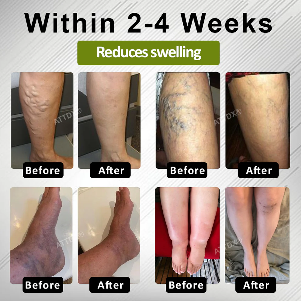 ATTDX® EdemaFree Flow Drain Massage Cream 3 ATTDX® EdemaFree Flow Drain Massage Cream
