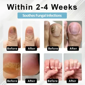 ATTDX® MycoStop Nail Recovery Serum Pen 7 ATTDX® MycoStop Nail Recovery Serum Pen