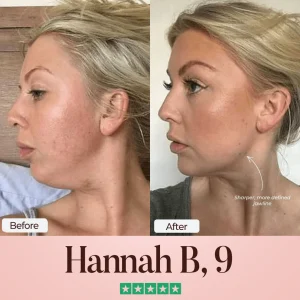 ChérieGlow SculptFix™ Kit 8 ChérieGlow SculptFix™ Kit