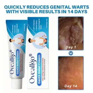 Oveallgo® HPV Genital Warts Relief Cream 8 Oveallgo® HPV Genital Warts Relief Cream