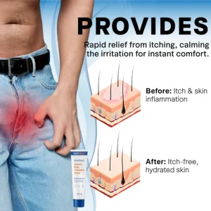 Fivfivgo® Scrotum Itchy Treatment Cream 7 Fivfivgo® Scrotum Itchy Treatment Cream