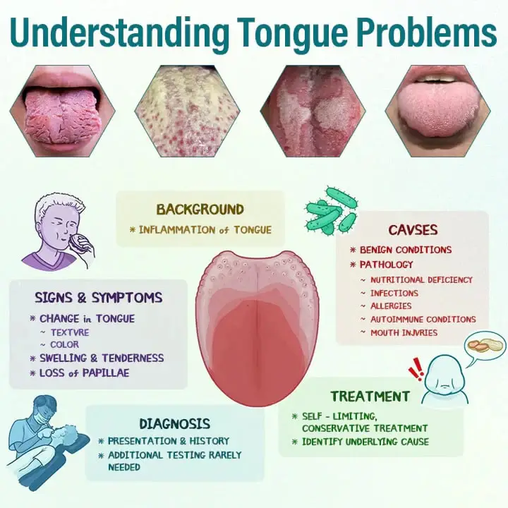 Oveallgo® GlosShield Tongue Repair Spray 2 Oveallgo® GlosShield Tongue Repair Spray