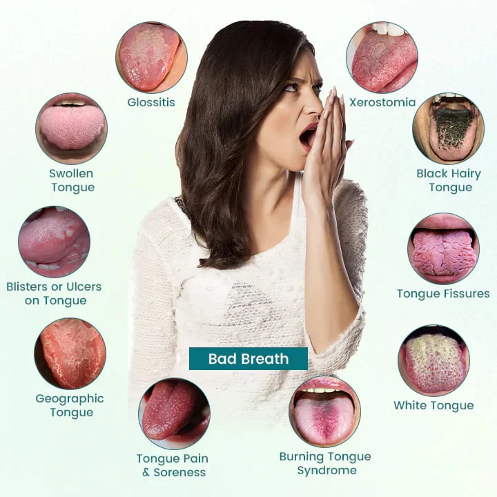 ATTDX® GlosShield Tongue Repair Spray 3 ATTDX® GlosShield Tongue Repair Spray