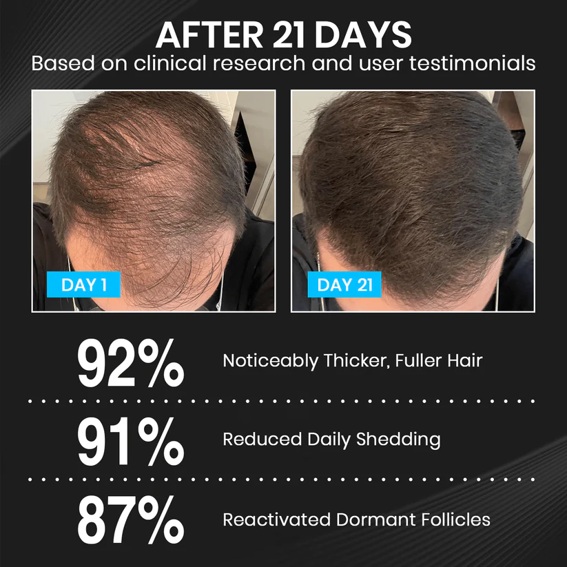 Lyyeto® HairRevix Advanced Hair Restoration Liquid Pearl 3 Lyyeto® HairRevix Advanced Hair Restoration Liquid Pearl