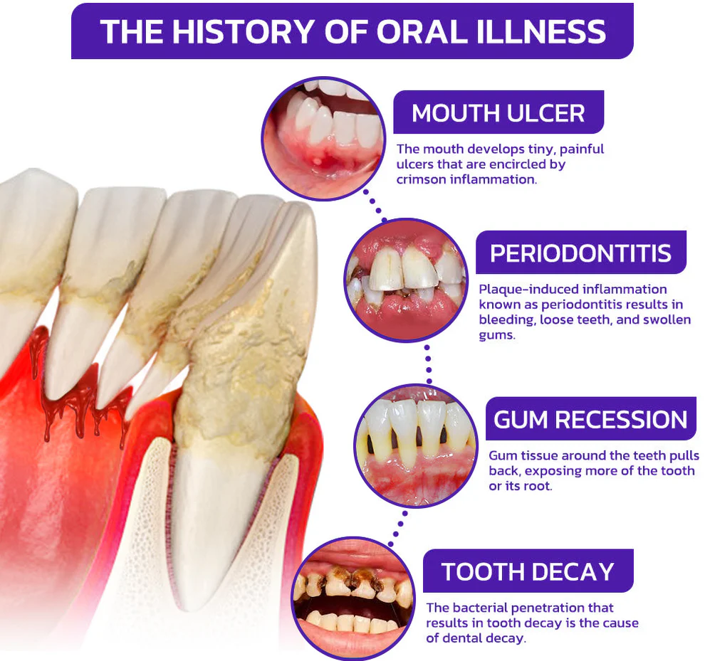 Cougex® VioGloss Bee Venom Dental Therapy Oral Power 5 Cougex® VioGloss Bee Venom Dental Therapy Oral Power