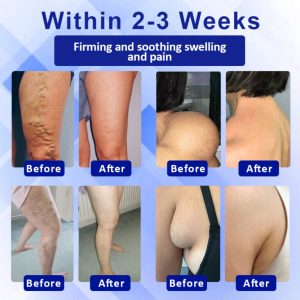 Elycura™ Lymphatic Drainage Massage Cream 7 Elycura™ Lymphatic Drainage Massage Cream